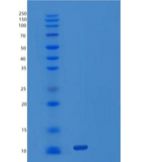 人激活素受体1A/激活素R1/ALK-2/ACV R1重组蛋白产品图