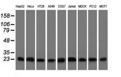 CLPP antibody [1D8]