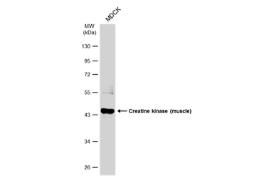 Creatine kinase (muscle) antib