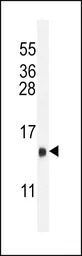LH beta antibody, C-term