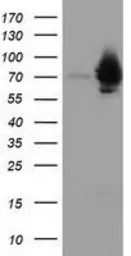 HSPA6 antibody [2C2]