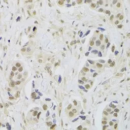 UBE3C antibody