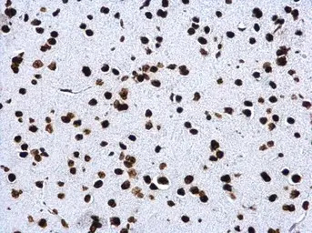 Histone H4K20me3 (trimethyl Ly