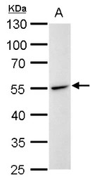 Desmin antibody