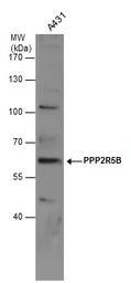 PPP2R5B antibody