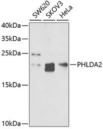 TSSC3 antibody