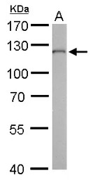 O-GlcNAc transferase antibody 