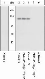 PKC mu (phospho Ser742) antibo