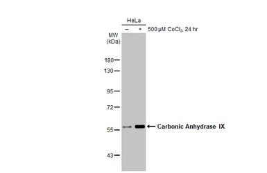 Carbonic Anhydrase IX antibody