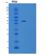人IL-1受体辅助蛋白/IL-1RAcP/IL-1R3重组蛋