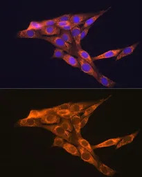VEGFB antibody