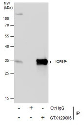IGFBP1 antibody