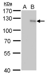 HIF1 alpha antibody [GT10211]