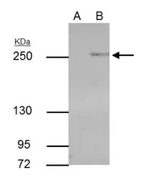 TET2 antibody [GT442]