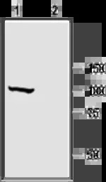 Maxi Potassium channel alpha a