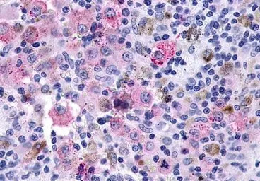 Glucagon like peptide 2 recept