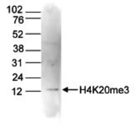 Histone H4K20me3 (trimethyl Ly