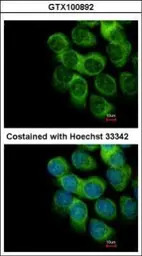 Thymidine Phosphorylase antibo