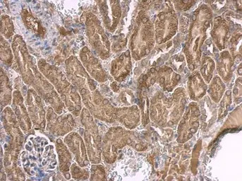 p53 antibody [C2C3], C-term