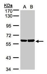 TBRG4 antibody