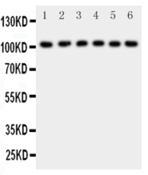 NFkB p105 antibody