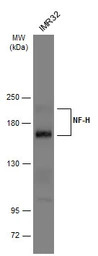 NF-H antibody