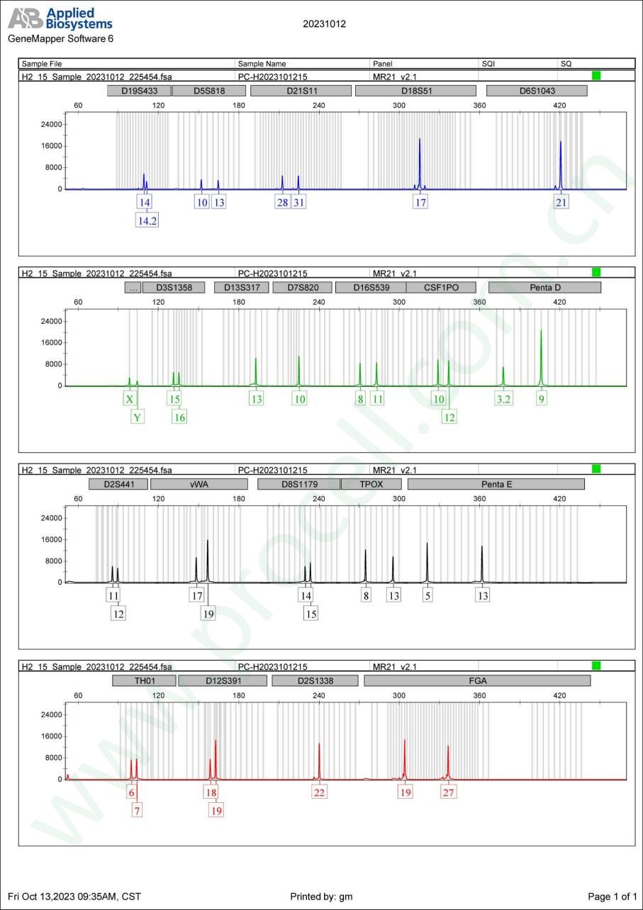 Raji（人Burkitt's淋巴瘤细胞）