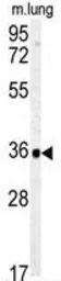 Carbonic anhydrase IV antibody