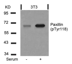 Paxillin (phospho Tyr118) anti