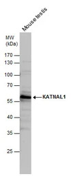 KATNAL1 antibody [C1C3]