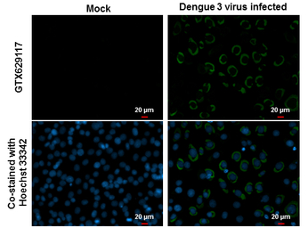 Dengue virus Envelope protein 