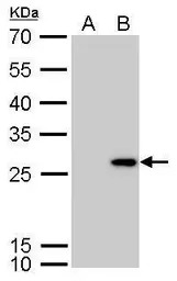 Calretinin antibody