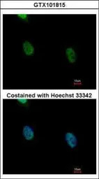 hnRNP K antibody