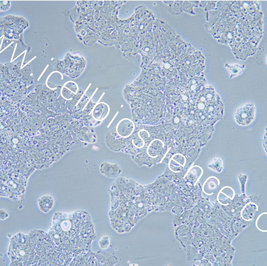 SW948 人结肠腺癌细胞/STR鉴定/镜像绮点（Cellverse）
