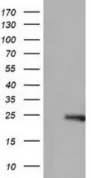 Rho GDI alpha antibody [1F2]