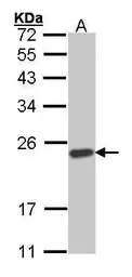 SOCS1 antibody
