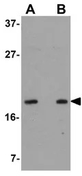 OCIAD2 antibody