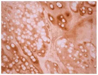 Osteocalcin antibody [OC4-30]