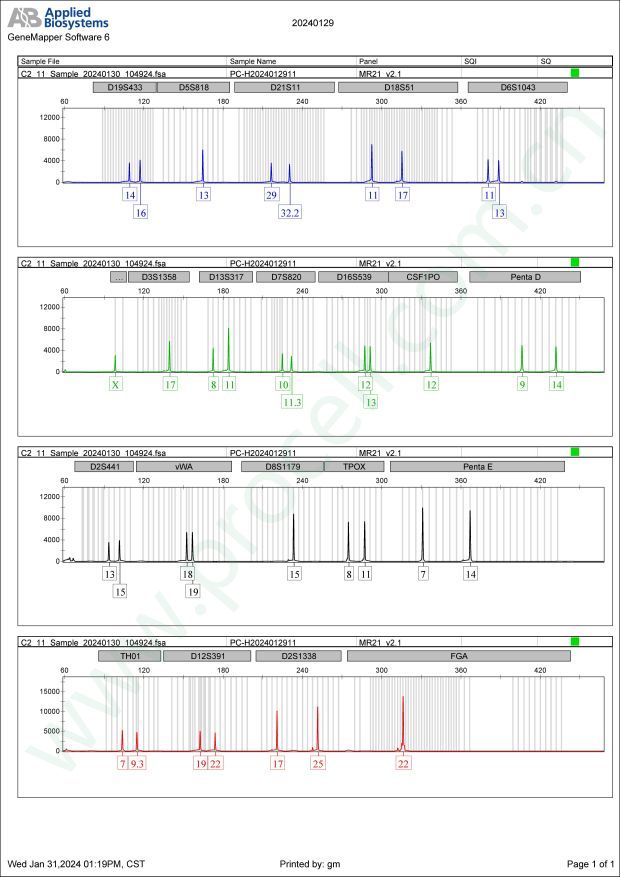 HCT-8 [HRT-18]（人回盲肠癌细胞）
