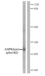AMPK beta 1 (phospho Ser182) a
