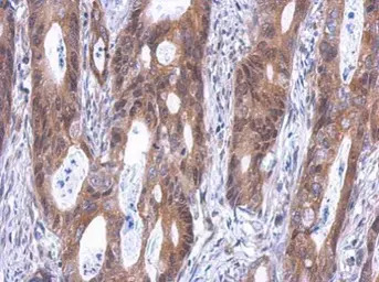 SLD5 antibody [N1C3]