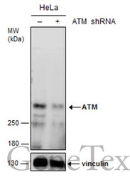 ATM antibody