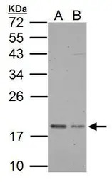 TRAPPC3 antibody
