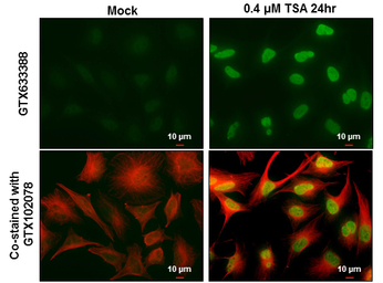 Histone H2AK5ac (acetyl Lys5) 