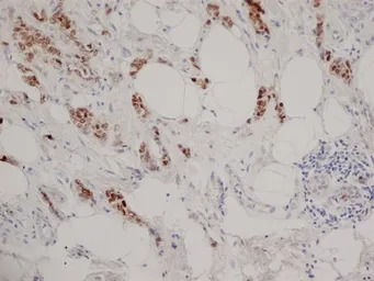 Progesterone Receptor antibody