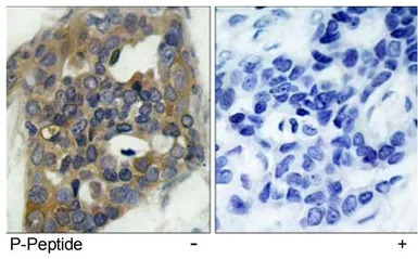 ASK1 (phospho Ser966) antibody