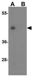 NP2 antibody