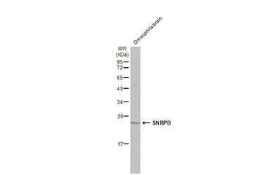 SNRPB antibody