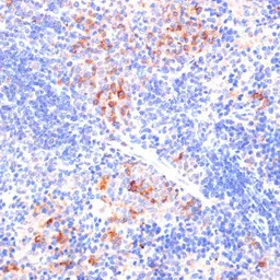 beta Arrestin 1 antibody