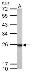 RAB33B antibody [N2C3]